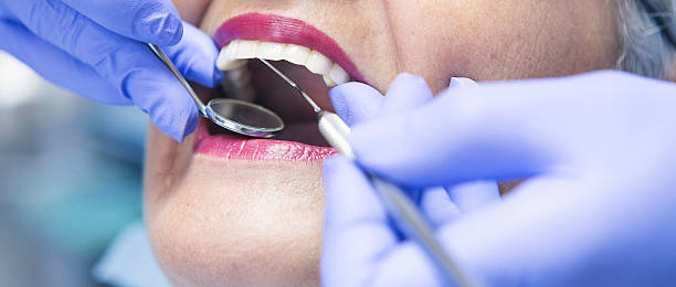Best Emergency Dentist for Knocked-Out Tooth in June Park, FL